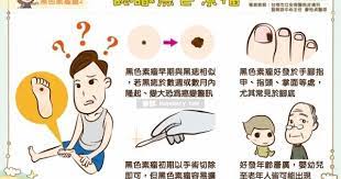 癌症保障怎麼選 重疾險 癌症險罹癌理賠大不同 comics peanuts comics