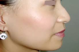 Xem tướng mũi Chuẩn để đoán vận mệnh Sang