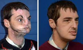 Can Plastic Surgery Fix An Ugly Face? - Quora