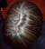 Child Premature Grey Hair