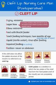 Cleft lip and cleft palate, also known as orofacial cleft, is a group of conditions that includes cleft lip, cleft palate, and both together. 37 Cleft Cutie Ideas Clefts Cleft Lip Cleft Lip And Palate