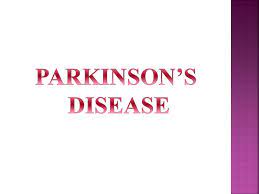 However, the disease affects about 50 percent. Parkinson S Disease Ppt Video Online Download