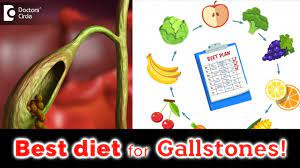 Once you have been diagnosed, it is essential to make some changes to your diet and habits to ensure improvement. Food And Drinks To Eat And Avoid If You Have Gallstones Dr Nanda Rajaneesh Doctors Circle Youtube