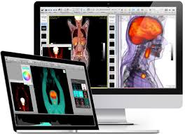 Free online dicom viewer and cloud pacs upload dicom images and clinical documents to postdicom servers. Osirix Dicom Viewer Osirix Md