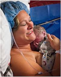 A family centered c-section