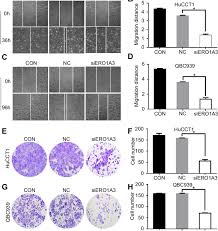 Ero1a Depletion Reduces Cca Cell Migration Ability A C