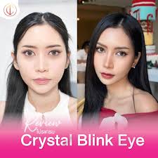 👀😨 ใต้ตาคล้ำ หน้าดูโทรม ใช่มั้ยคะ ต้องรีบมา อินชอน คลินิก‼️ 🥰  มาเปลี่ยนตาที่ดูเหนื่อยล้า ให้กลับสดใสแบบพี่สาวเกาหลี 🇰🇷 💉  ฉีดแล้วเห็นผลจริง หน้าไบรท์ตาแบ๊วทันตา จนใครๆ ต้องหันมอง ✨️ 💗  ปรึกษาฟรีไม่มีค่าใช้จ่าย 💗 🕍 𝐈𝐍𝐂𝐇𝐄𝐎𝐍 𝐂𝐋𝐈𝐍𝐈𝐂 ...