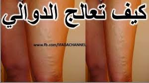 Check spelling or type a new query. Ø¹Ù„Ø§Ø¬ Ù„Ù„Ù‚Ø¶Ø§Ø¡ Ø¹Ù„Ù‰ Ø§Ù„Ø¯ÙˆØ§Ù„ÙŠ Ù‚ÙˆÙŠ ÙˆØ·Ø¨ÙŠØ¹ÙŠ ÙƒÙŠÙ Ø§Ù„ØªØ®Ù„Øµ Ù…Ù† Ø¯ÙˆØ§Ù„ÙŠ Ø§Ù„Ø³Ø§Ù‚ÙŠÙ† Ù…Ø¬Ø±Ø¨Ø© Youtube