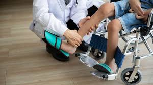 Image result for Μυϊκή Δυστροφία Ντουσέν