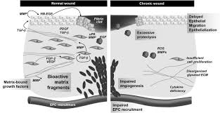 Examples include atopic dermatitis (eczema), contact dermatitis and seborrheic dermatitis (dandruff). Protease Technology In Wound Repair Sciencedirect