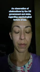 Obstructions to work/income to afford it, financial/refugee assistance for  it, causing other stagnating of it. Something worried them about it to be  like that. ...