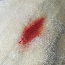 A stiff brush can be used to try and groom the dried blood out of the carpet. Cleaning A Blood Stained Bath Towel Simply Good Tips