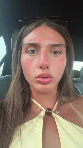 The Feeling of Being Bald