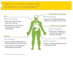 The symptoms affect many parts of the body. Anaphylaxis Asthma And Allergy Affiliates