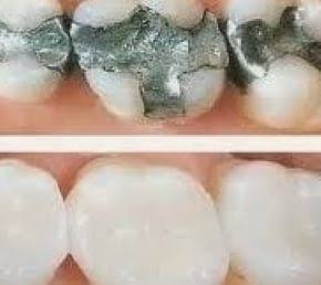 Filling product image