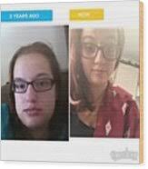 No Swollen Face This Year!!! Photograph by Carmen Bone