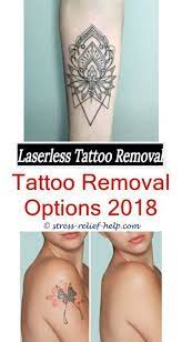 Can Tattoos Be Removed Completely What Is The Best Laser For Black Tattoo Removal Is Removing T Tattoo Removal Cost Tattoo Removal Cream Diy Tattoo Permanent