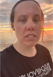 Watch me process getting stung by jimbles for the first time 🪼😂  #jellyfish #jimble #australianbeaches