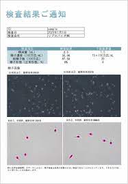 男の妊活】俺の精子は大丈夫？オンライン診療を記者が受けてみた！｜ニュースイッチ by 日刊工業新聞社