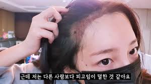 Check spelling or type a new query. ìˆ˜ìˆ  ë°›ì•˜ë‹¤ Bj ì™¸ì§ˆí˜œ ì¶©ê²©ì ì¸ ë¨¸ë¦¬ ìƒíƒœ ê³µê°œí–ˆë‹¤