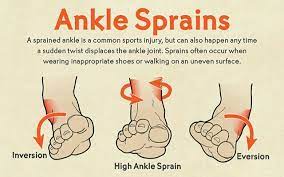 Kaki saya selalu bengkak dan ketika saya berjalan, saya selalu letih. Jangan Sapu Dengan Minyak Panas Ini 4 Tip Cepat Yang Perlu Buat Lepas Kaki Terseliuh Maskulin