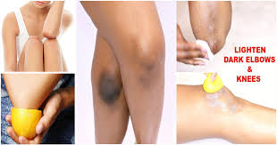 Scrub gently for some time and leave the mixture on for about 30 minutes. Natural Beauty Tips 5 Simple Home Tricks To Destroy Dark Knees And Elbows And Be Cool This Summer