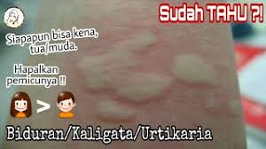 Selepas itu, saya masukkan 'syringe' hingga ke hujung. Omalizumab Apa Ubat