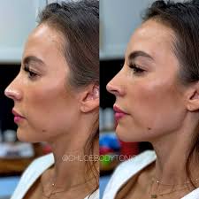 Chloe Francois (@chloebodytonic) • Instagram photos and videos