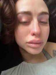 Fundraiser for Katherine Walden by Fran Sanders : Help out Lucy  Walden-Navarro