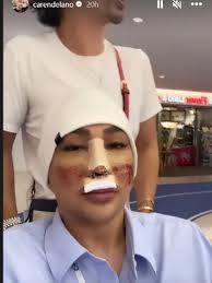 6 Potret Caren Delano Jalan-Jalan di Korea Usai Operasi, Wajah Masih  Diperban