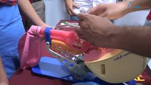 Image result for Extraglottic Device