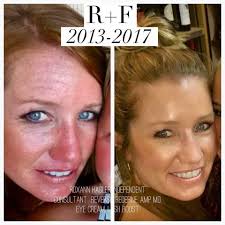 There's a reason our regimens have a sticker