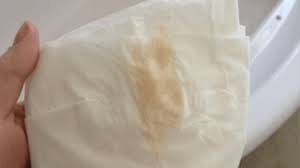 Last Van Bruine Afscheiding Of Slijm Tijdens De Zwangerschap