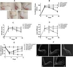 Exploration Of Bromelain Laden Nanostructured Lipid Carriers An Oral Platform For Bromelain Delivery In Rheumatoid Arthritis Management Sciencedirect