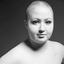 True cancer stories: "I was diagnosed at 23."