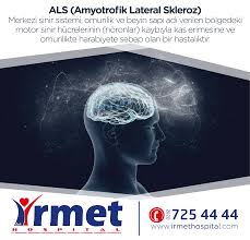 Als Hastaligi Nin Belirtileri Nelerdir Hastanin Fark Ettigi Ilk Belirti Genellikle Bir Kolda Ya Da Bacakta Gucsuzluk Ya Da Incelmedir Orn Kaleler Gulme Kas