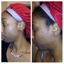 African black soap is combined with shea butter, oats, and aloe, in a balancing formula that's great for cleansing. How I Cleared My Skin Shea Moisture African Black Soap Review Youtube