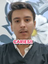 Que son las caries y como se tratan? #manzanillo #dentista