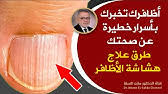كنز جعله الله علاج دوالي الساقين ويشفي بسرعة، يقدم الدكتور مازن السقا طرق طبيعية لمحاربة الأوردة العنكبوتية علاج دوالى الساقين بالحقن هى تقنية طبية لعلاج دوالي الساقين بالإبر يتم من خلالها حقن مادة داخل الوريد المصاب. ÙƒÙ†Ø² Ø¬Ø¹Ù„Ù‡ Ø§Ù„Ù„Ù‡ Ø¹Ù„Ø§Ø¬ Ø¯ÙˆØ§Ù„ÙŠ Ø§Ù„Ø³Ø§Ù‚ÙŠÙ† ÙˆÙŠØ´ÙÙŠ Ø¨Ø³Ø±Ø¹Ø© Ø·Ø±Ù‚ Ø·Ø¨ÙŠØ¹ÙŠØ© Ù„Ù…Ø­Ø§Ø±Ø¨Ø© Ø§Ù„Ø£ÙˆØ±Ø¯Ø© Ø§Ù„Ø¹Ù†ÙƒØ¨ÙˆØªÙŠØ© ÙˆØ¯ÙˆØ§Ù„ÙŠ Ø§Ù„Ø³Ø§Ù‚ÙŠÙ† Youtube
