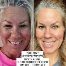 Profile for Rodan + Fields with Melinda Serrano Granger