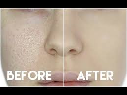 The Best Primers For Large Pores What To Use For Oily Skin Dry Skin Sensitive Skin Combination Skin With Tips T Poreless Skin Enlarged Pores Nose Pores