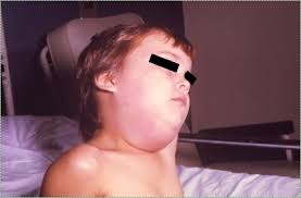 Histology of glands, lymphatics and sinuses