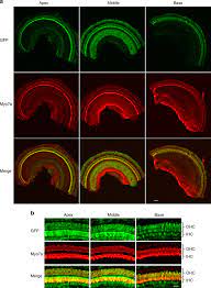 Check spelling or type a new query. Aav2 7m8 Infects Inner And Outer Hair Cells Throughout The Entire Download Scientific Diagram