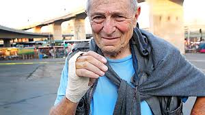 Renowned lensman bitten in robbery