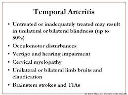 Pin By Sandi Montgomery On Cardiology Rotation Temporal Arteritis Giant Cell Arteritis Polymyalgia Rheumatica