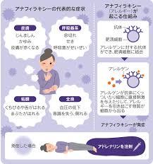 Ecchi / ギャグ・コメディ / ラブコメ / ロマンス / 学園. ã‚¢ãƒŠãƒ•ã‚£ãƒ©ã‚­ã‚·ãƒ¼å›½å†…3ä¾‹ç›® æ–°åž‹ã‚³ãƒ­ãƒŠãƒ¯ã‚¯ãƒãƒ³ æ—¥æœ¬çµŒæ¸ˆæ–°èž