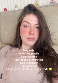 Provavelmente a pergunta campeã… qual valor da lipo de papada??? Vem v...