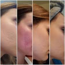 New Cloud 9 In Redlands Redlands Cloud 9 Medispa