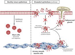 Check spelling or type a new query. Mast Cells In Asthma State Of The Art Bradding 2016 Clinical Amp Experimental Allergy Wiley Online Library