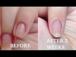 How To Grow Your Nails Really Fast And Long In Just 10 Days Mamtha Nair Youtube Nail Growth Remedies How To Grow Nails Make Nails Grow